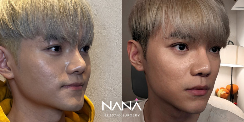 Before & After Before & After