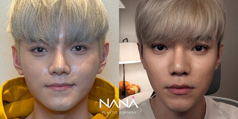 Men Before & After — Before & After
