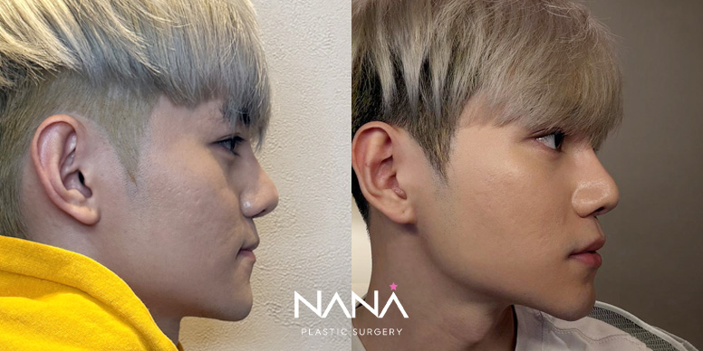 Before & After Before & After