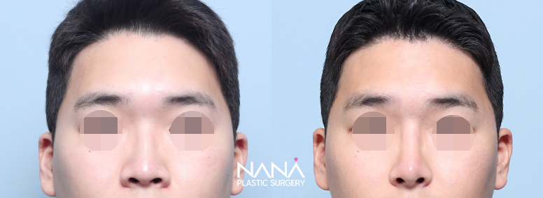 Before & After Before & After