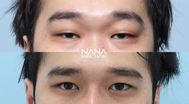 Men Before & After — Before & After