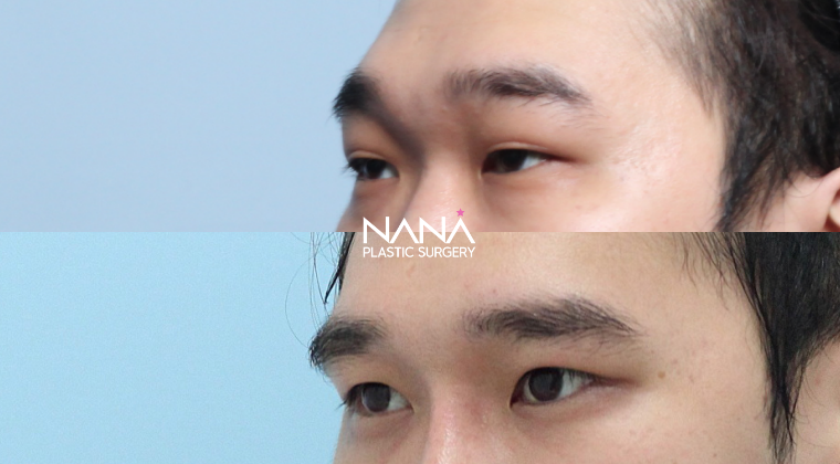 Before & After Before & After