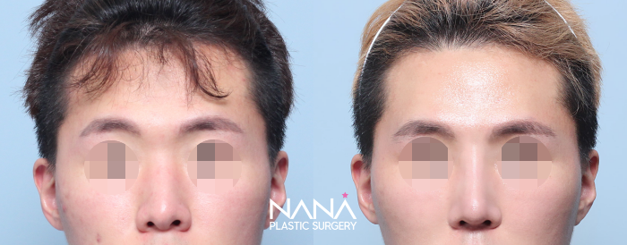 Before & After Before & After