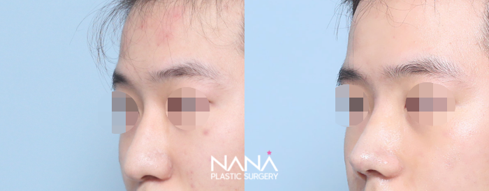 Men Before & After — Before & After