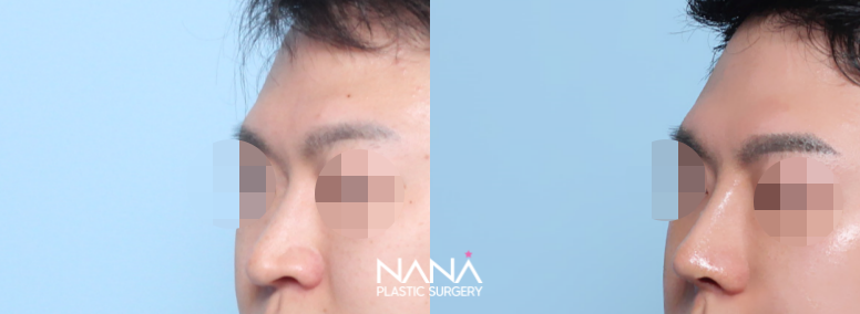 Men Before & After — Before & After