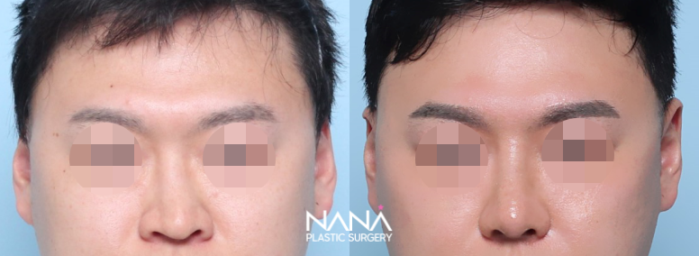 Before & After Before & After