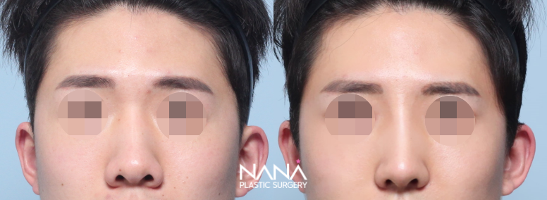 Before & After Before & After