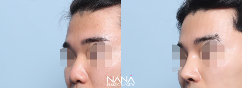 Men Before & After — Before & After
