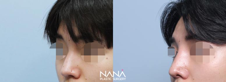 Men Before & After — Before & After