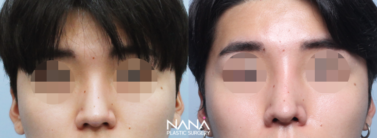 Before & After Before & After