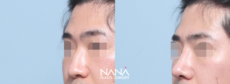 Men Before & After — Before & After