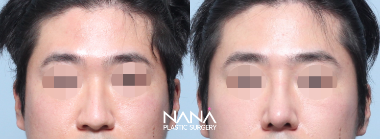 Before & After Before & After