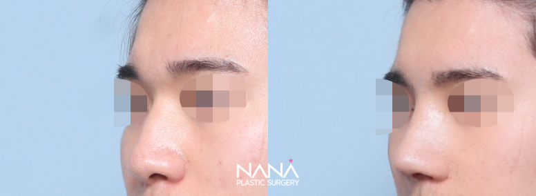 Men Before & After — Before & After