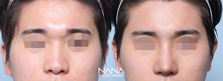 Before & After Before & After