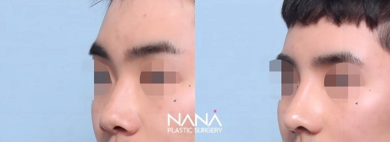 Men Before & After — Before & After