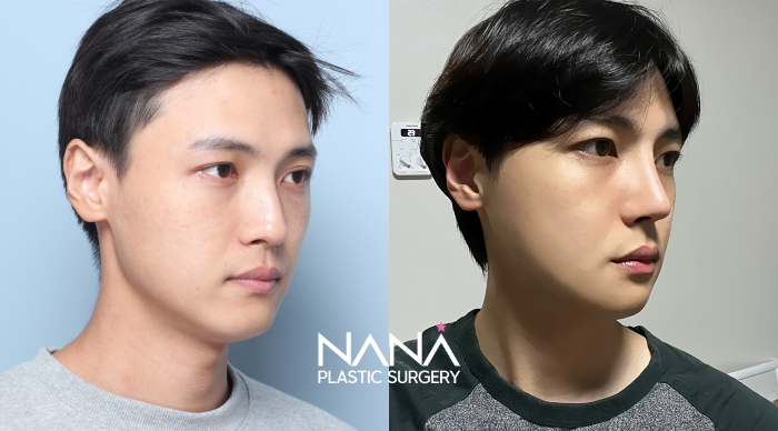 Before & After Before & After