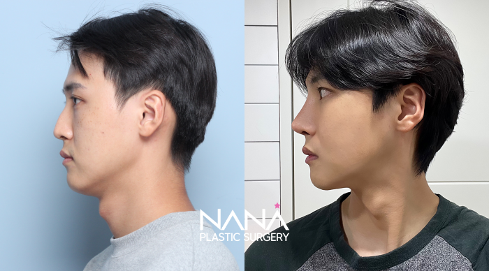 Before & After Before & After