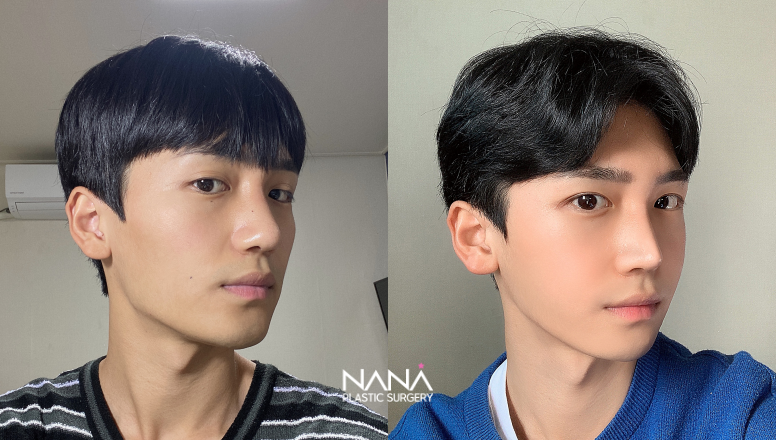 Before & After Before & After