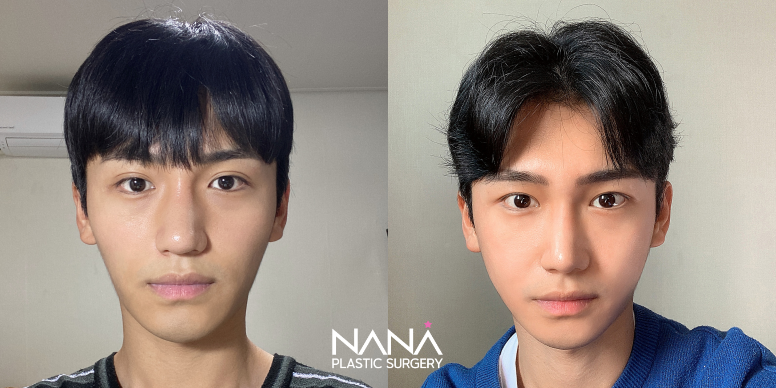 Men Before & After — Before & After