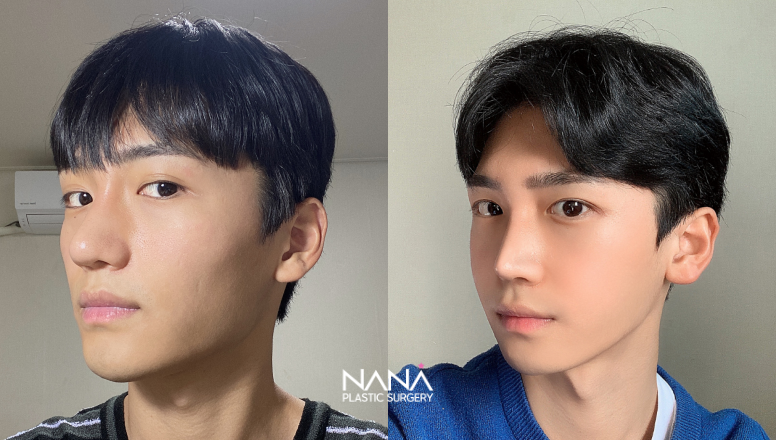 Before & After Before & After