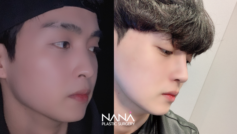 Before & After Before & After