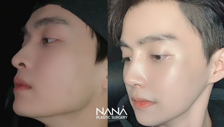Before & After Before & After