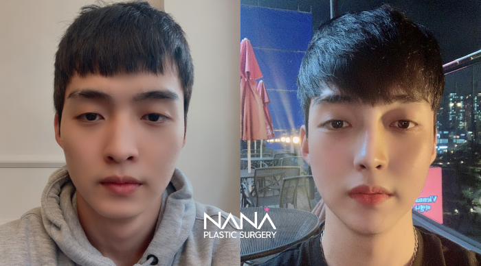Men Before & After — Before & After