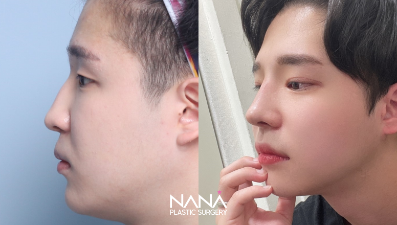 Before & After Before & After