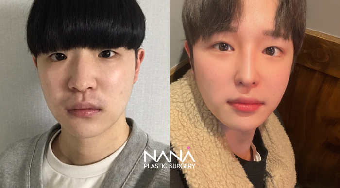 Men Before & After — Before & After