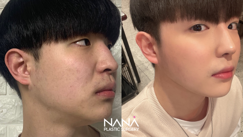 Before & After Before & After