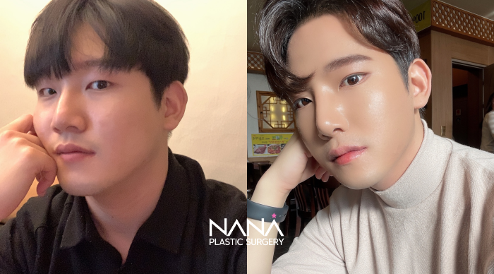 Before & After Before & After