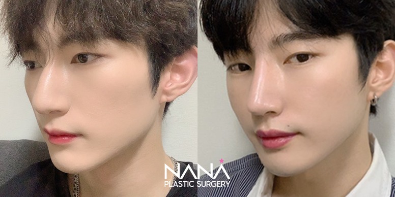 Before & After Before & After