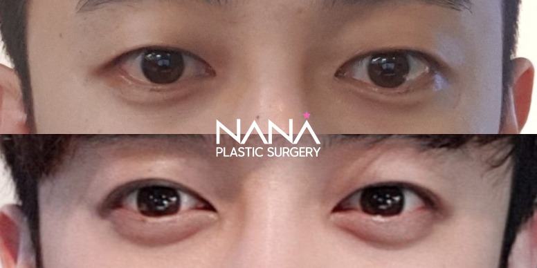 Men Before & After — Before & After