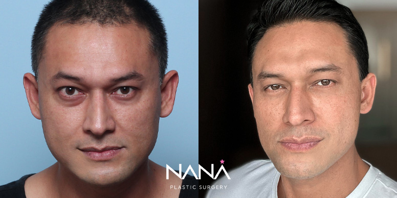 Men Before & After — Before & After