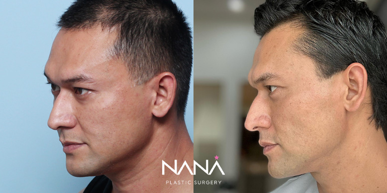 Before & After Before & After