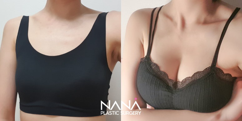 Before & After Before & After