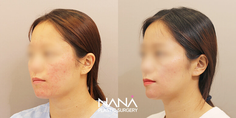 Before & After Before & After
