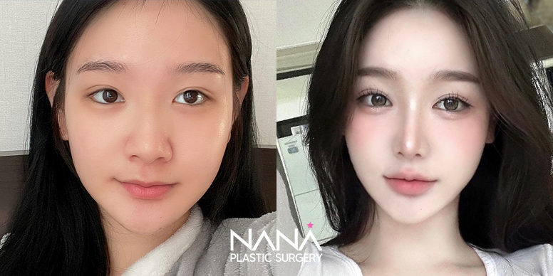 Before & After Before & After