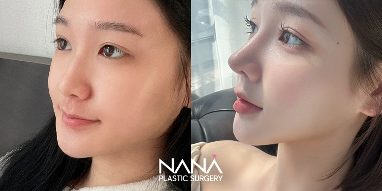 Before & After Before & After