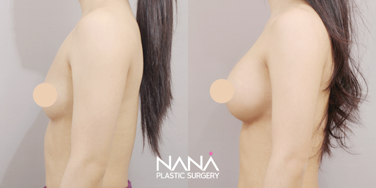 Before & After Before & After