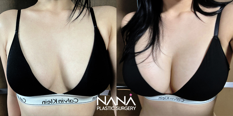 Before & After Before & After
