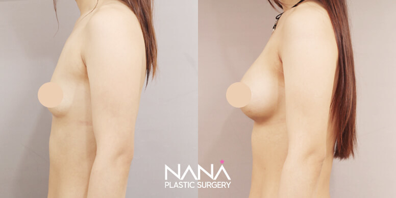 Before & After Before & After