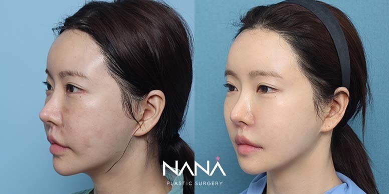 Before & After Before & After