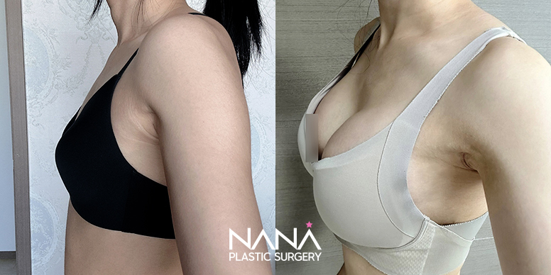 Before & After Before & After