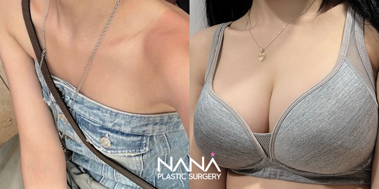 Before & After Before & After
