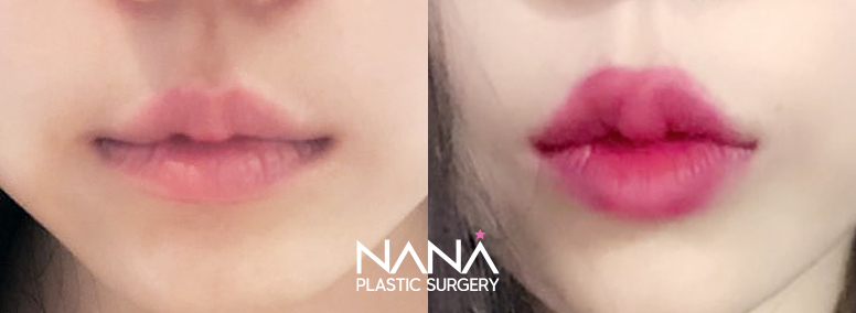 Other Before & After — Before & After