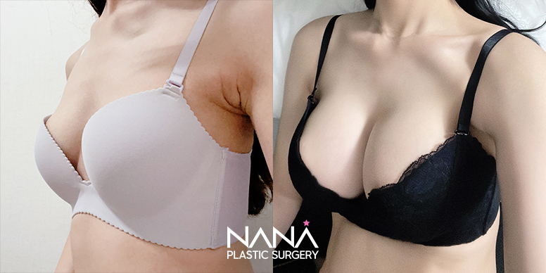 Before & After Before & After