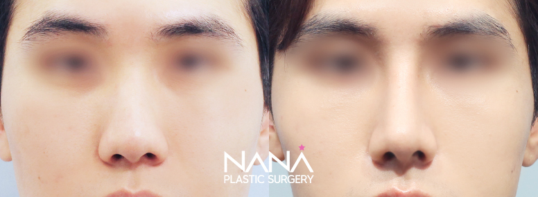 Before & After Before & After