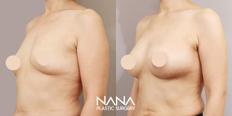 Before & After Before & After