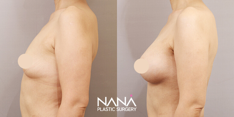 Before & After Before & After